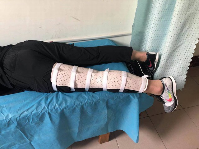 膝枢纽低温