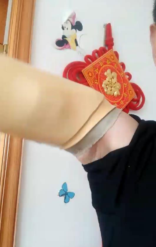 康复实例